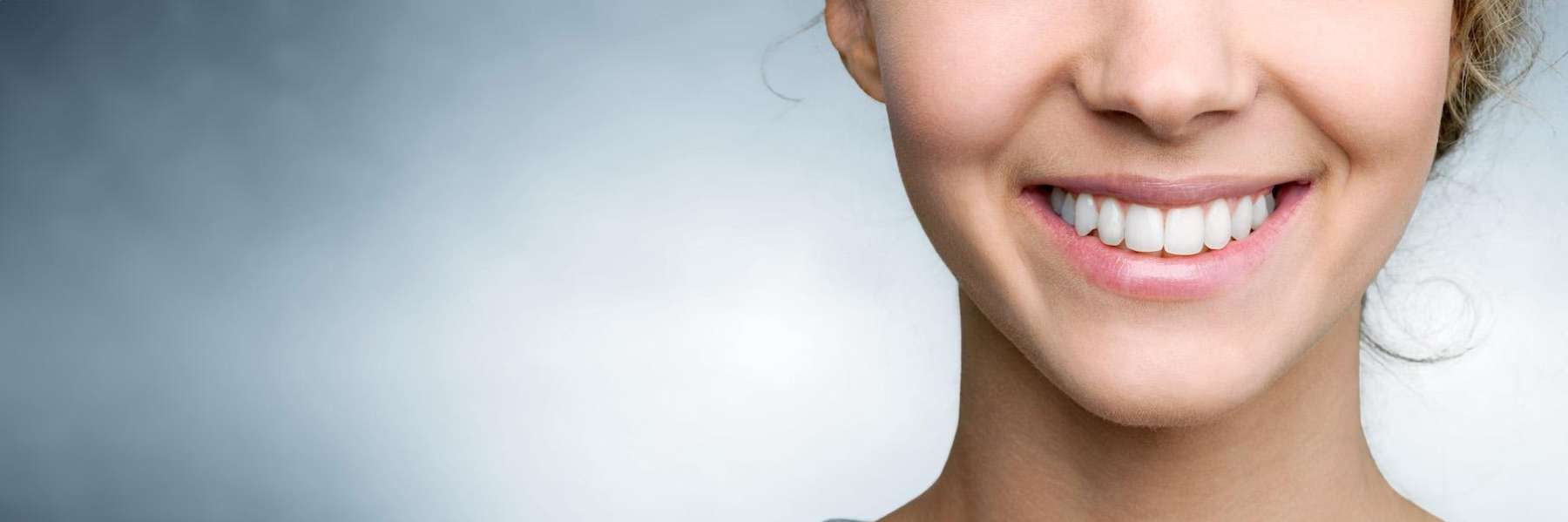 woman after teeth whitening in cloverdale