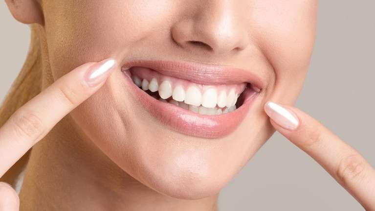 woman with white teeth in cloverdale