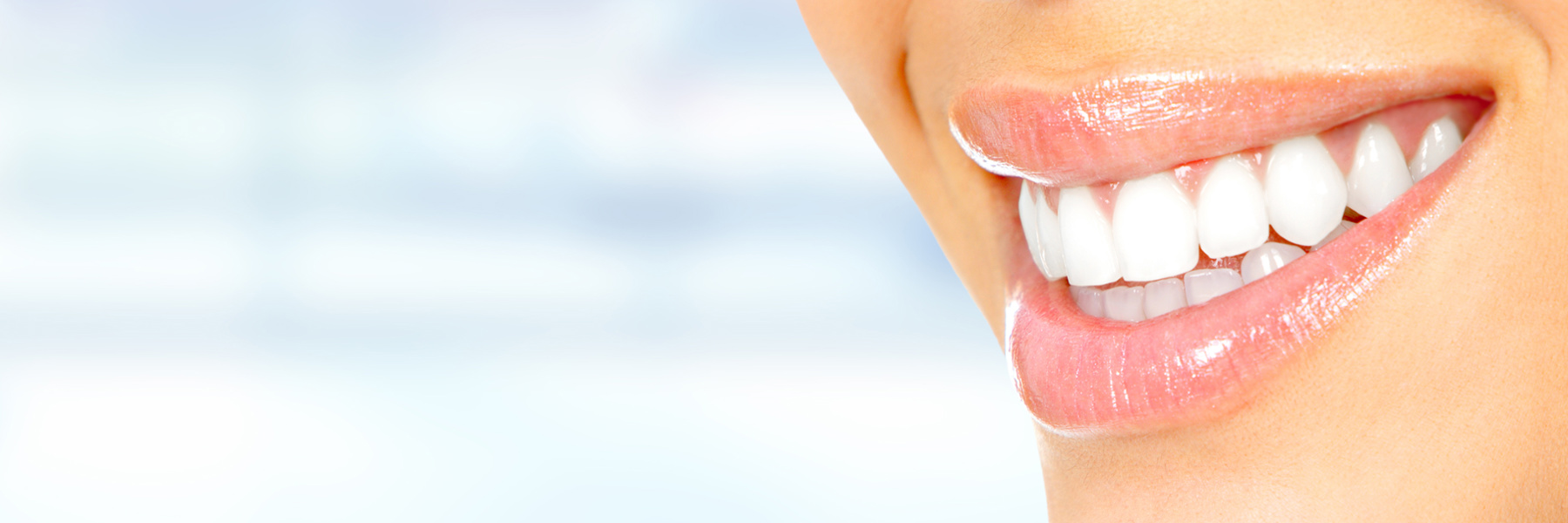 Porcelain Veneers | Dentist